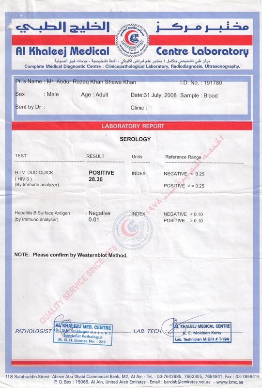 HIV AIDS, HIV, AIDS, HIV AIDS Treatment, HIV Treatment, AIDS Treatment, HIV AIDS, HIV, AIDS, Herbal, Alternative Medicine, HIV Treatment Success