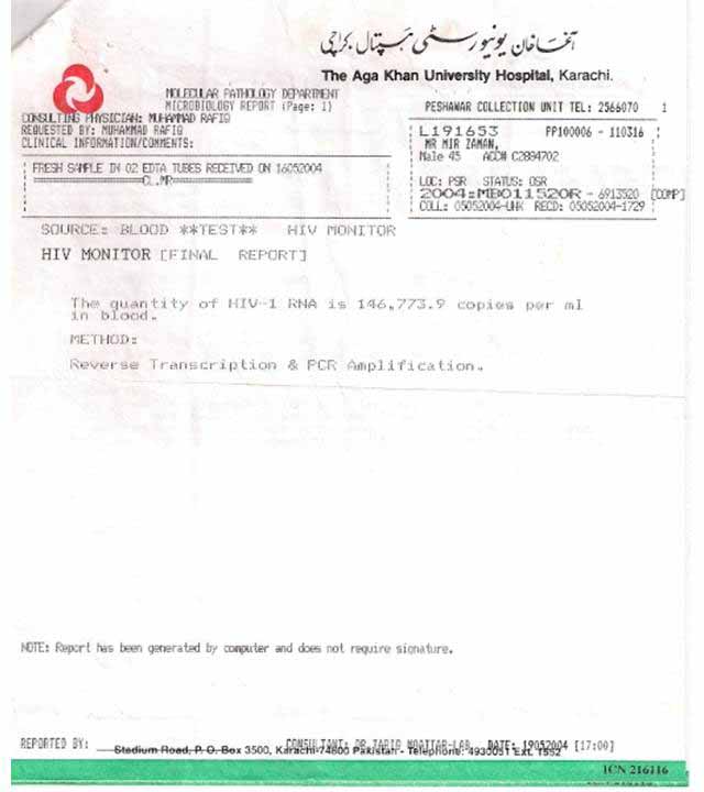 HIV AIDS, HIV, AIDS, HIV AIDS Treatment, HIV Treatment, AIDS Treatment, HIV AIDS, HIV, AIDS, Herbal, Alternative Medicine, HIV Treatment Success